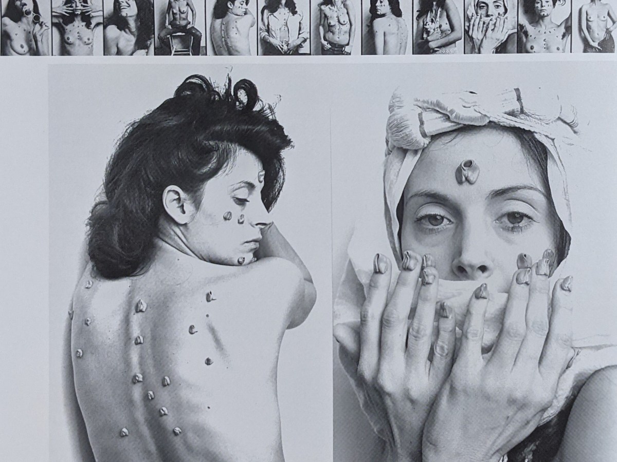 Monstruos heridos, cuerpos&nbsp;dolientes